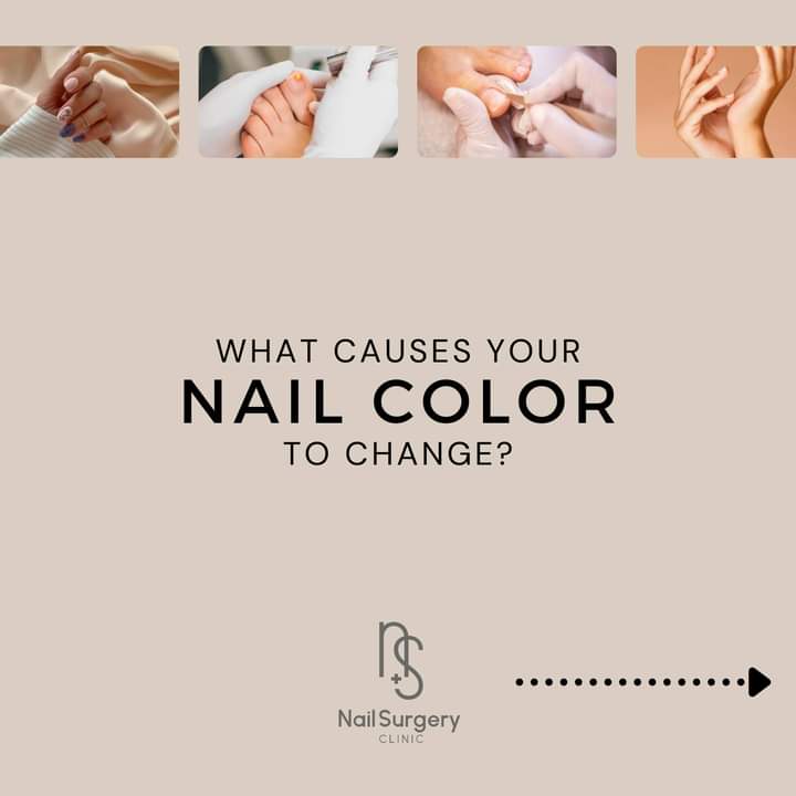 Why your nails seem to have a different color?