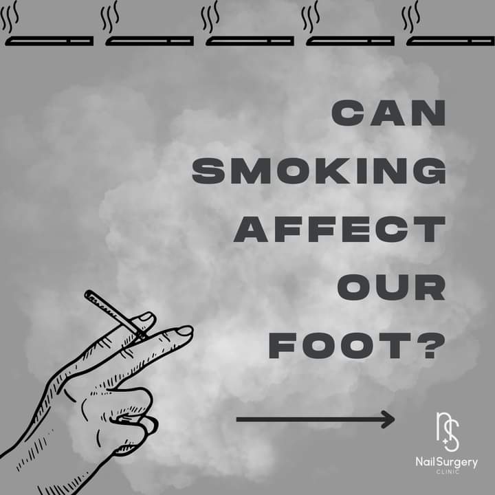 How smoking can harm your foot’s health